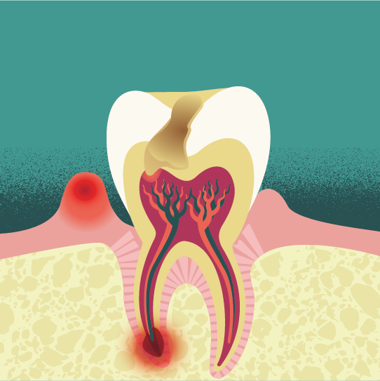 Kick Sugar tooth illustration